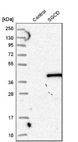 delta-Sarcoglycan Antibody, Novus Biologicals:Antibodies:Primary Antibodies